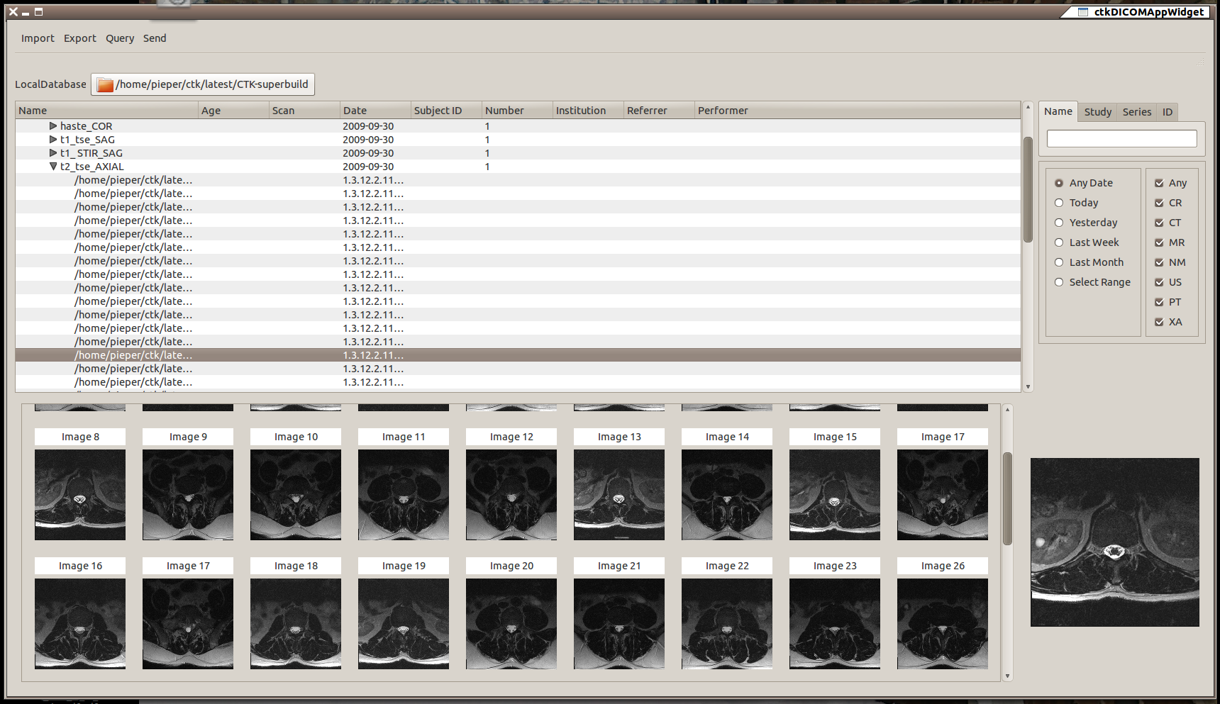State of the ctkDICOM application as of 3:26pm on Friday afternoon.